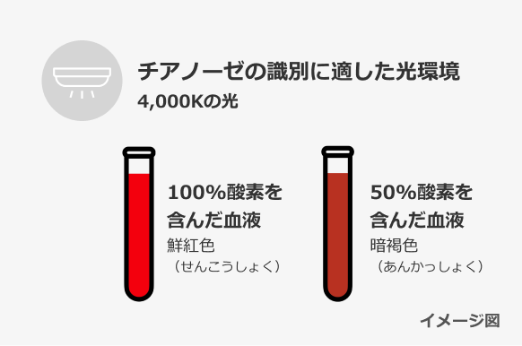 チアノーゼの識別に適した光環境